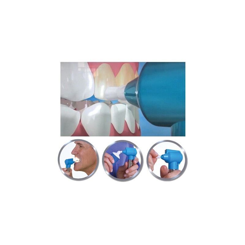Sistema-za-premahvane-na-petna-i-polirane-na-zbi-Luma-Smile-1261