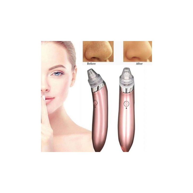 Vakuumen-ured-za-pocistvane-na-lice-i-premahvane-na-cerni-tocki-G171830